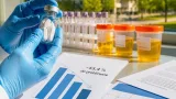 La FDA accorde une approbation accélérée à Ultomiris d’AstraZeneca pour une néphropathie rare